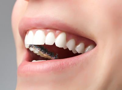 做种植牙修复脱落牙齿的优点有哪些-成都种植牙厂家