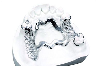 牙齿支架修复：恢复口腔健康与美观的解决方案 | 义齿厂家