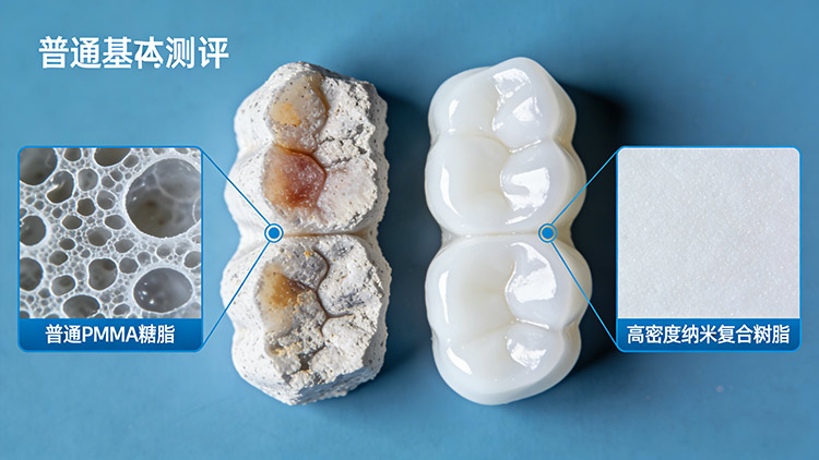 义齿发黄、松动、有异味?成都义齿厂家解析三大问题根源与应对方案